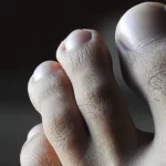 Here’s How To Naturally Treat Ingrown Toenails